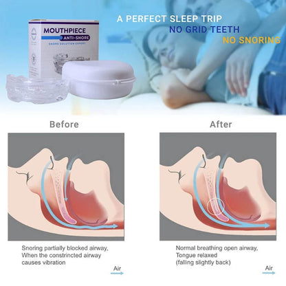 Portable Anti Snoring Devices with Storage Box for Sleep Quality